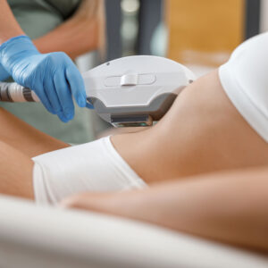 Ultraformer-Corporal