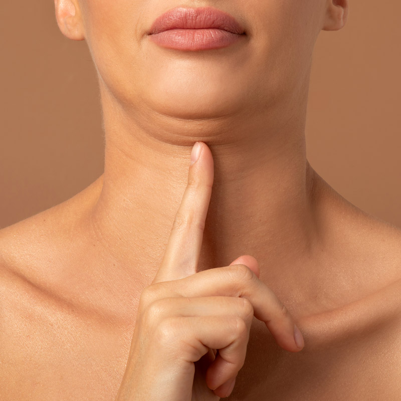 Mesolipo-Facial
