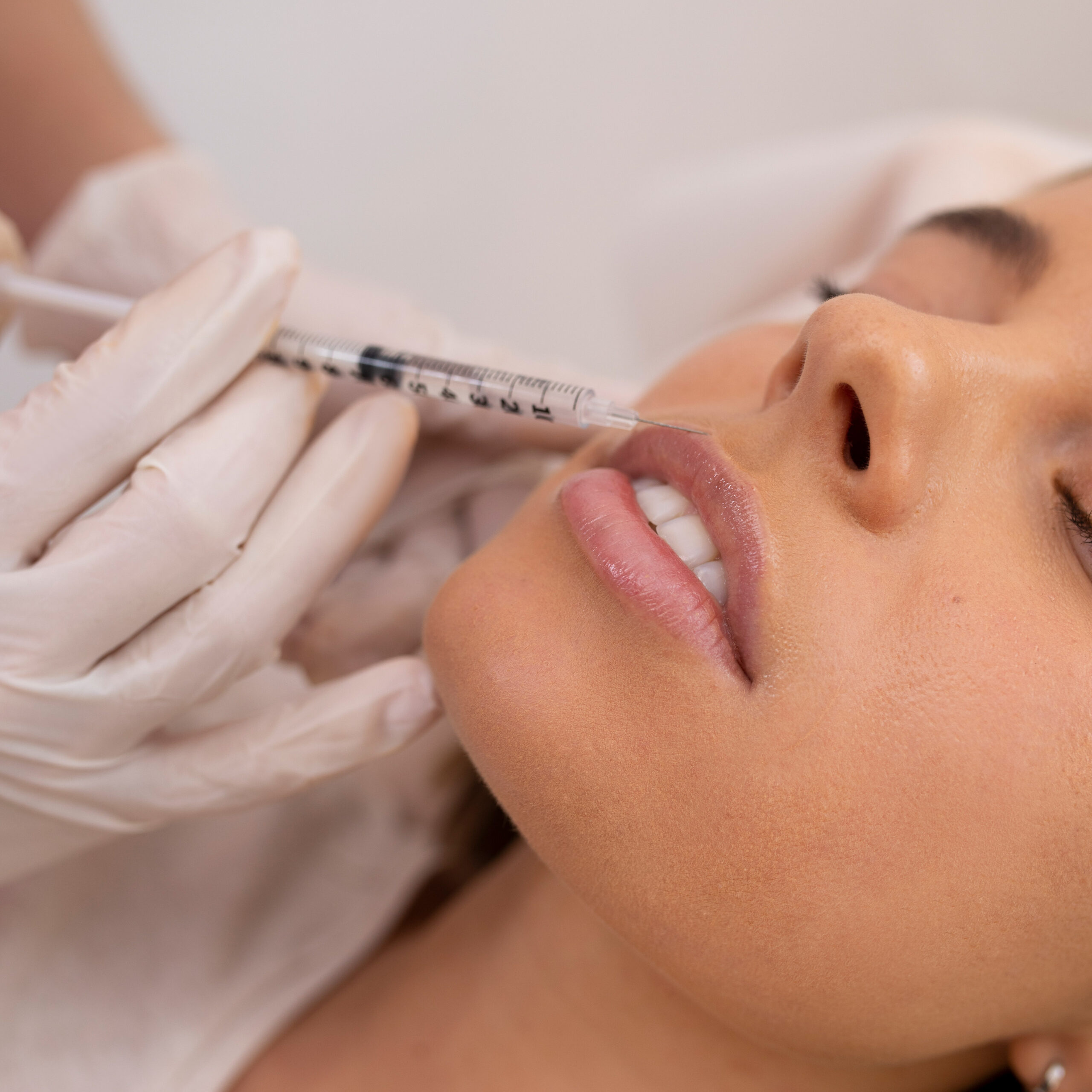Preenchimento-Labial