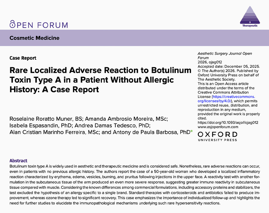 Rare-Localized-Adverse-Reaction-to-Botulinum-Toxin-Type-A-in-a-Patient-Without-Allergic-History--A-Case-Report